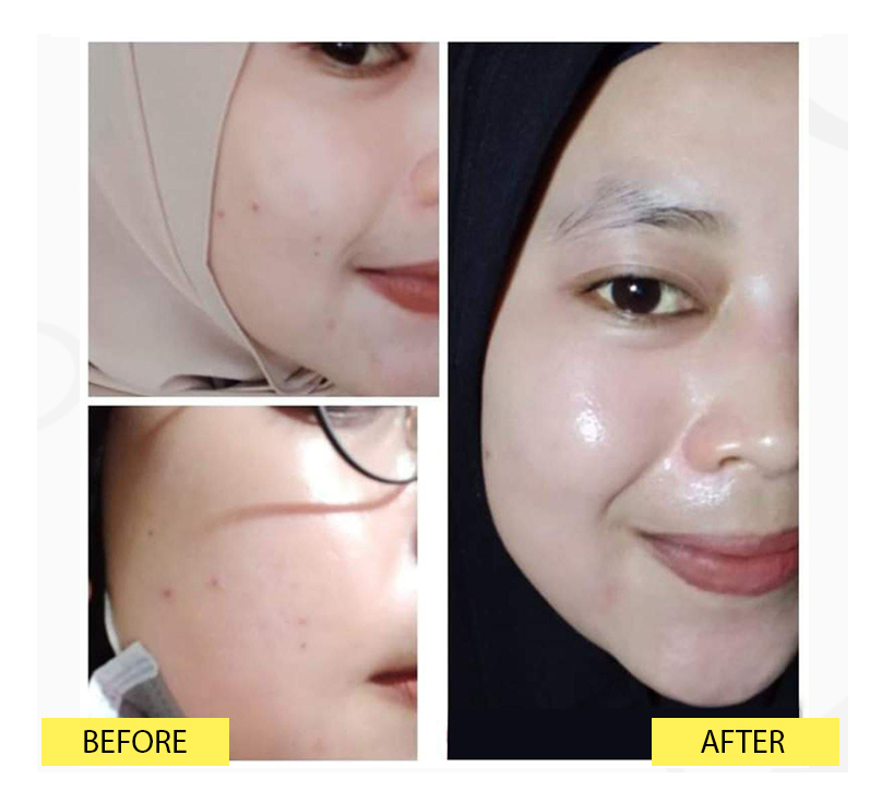 EXCLUSIVE OILY NIGHT CREAM